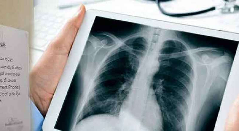 எக்ஸ்ரே பிலிம்களுக்கு தட்டுப்பாடு : கடும் சிரமத்தை எதிர்நோக்கும் நோயாளிகள்!