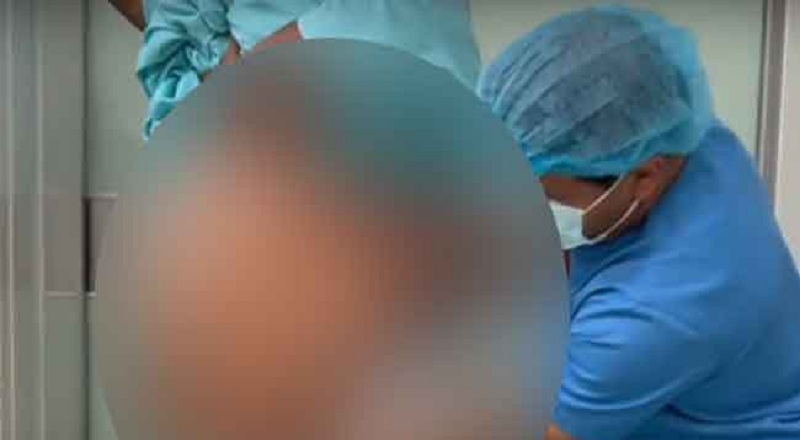 கண்டியில் உடற்பருமனை குறைக்க 61 வயது பெண்ணுக்கு சத்திரசிகிச்சை!