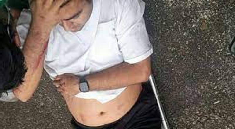 ரயிலில் பயணித்த ஈரானிய சுற்றுலாப் பயணிக்கு நேர்ந்த துயரம்!