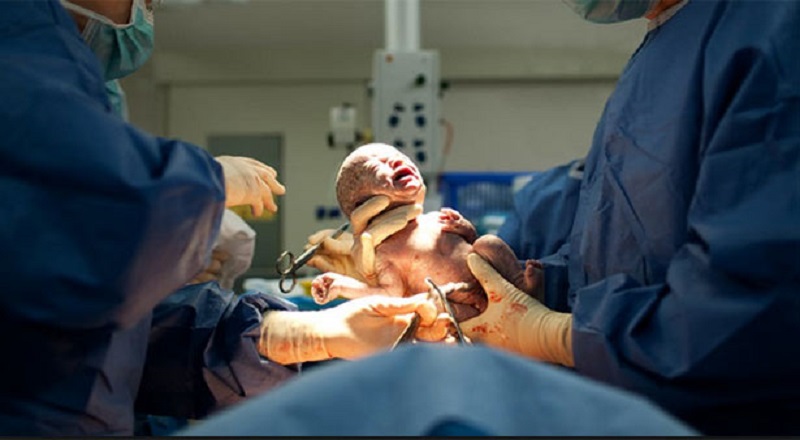 களுத்துறை போதனா வைத்தியசாலையில் சிசேரியன் சிகிச்சை நிறுத்தம்