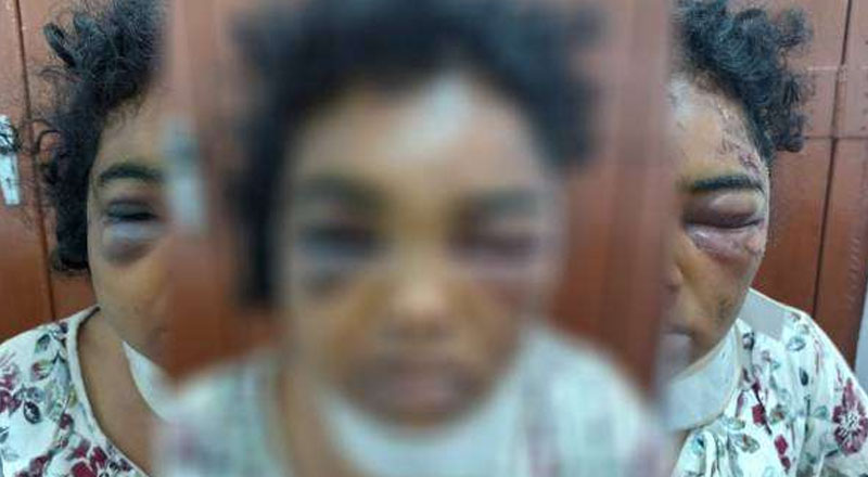 கிளிநொச்சியில் கணவரால் கொடூரமாக தாக்கப்பட்ட இளம் பெண்!