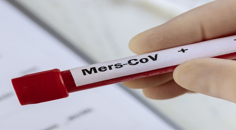 அபுதாபியில் MERS வைரஸ் தொற்றால் இளைஞன் பாதிப்பு