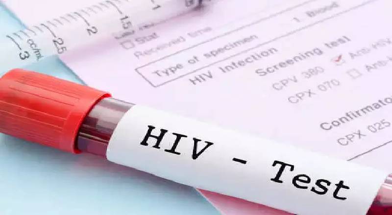 இலங்கையில் அதிகரித்தது எச்.ஐ.வி தொற்றாளர்களின் எண்ணிக்கை!