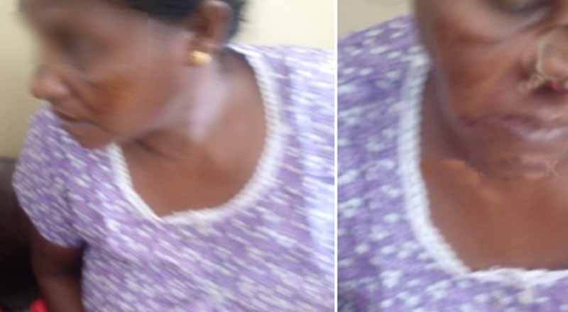 தொடரும் பொலிஸாரின் அடாவடி: பெண்ணொருவர் தாக்கப்பட்டு வைத்தியசாலையில் அனுமதி