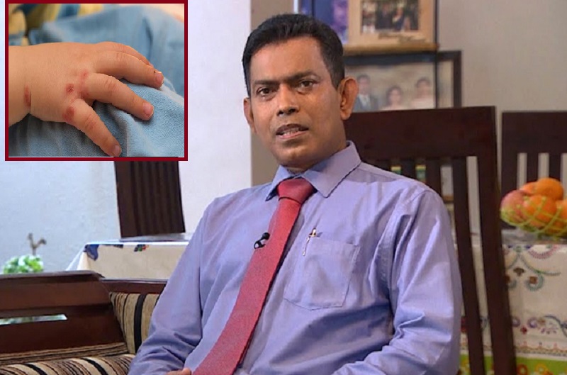 நாட்டில் தீவிரமாக  பரவும் நோய்: சிறுவர்கள் தொடர்பில்  விசேட வைத்திய நிபுணர் விடுத்துள்ள எச்சரிக்கை